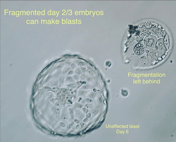 Post image - Can Fragmented Day 3 Embryos Make it to Blastocyst?