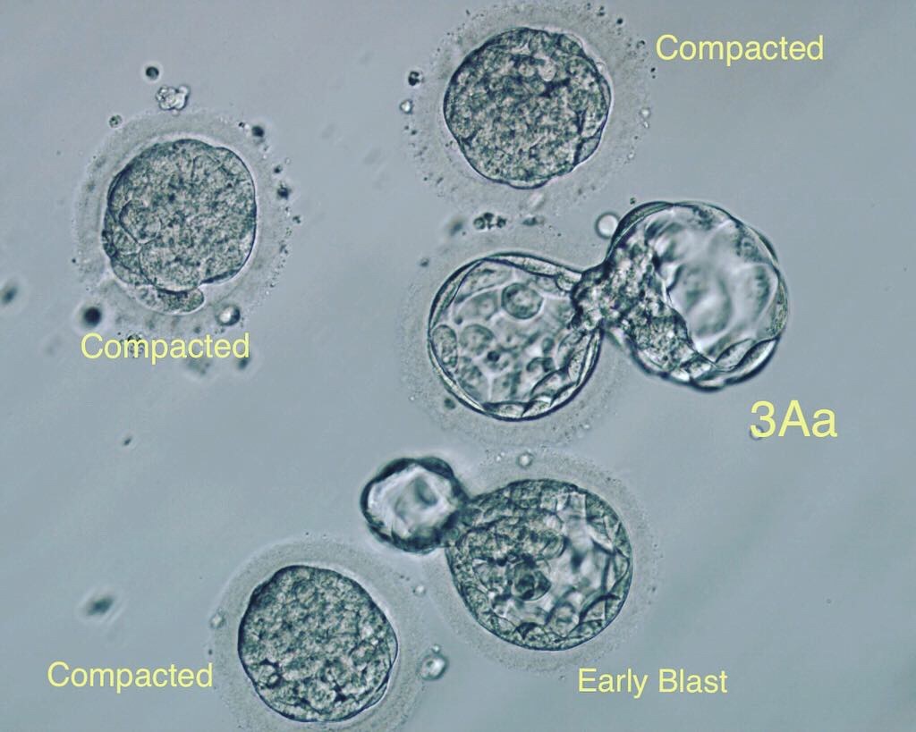 Post image - When you don't reach blastocyst by day 5...