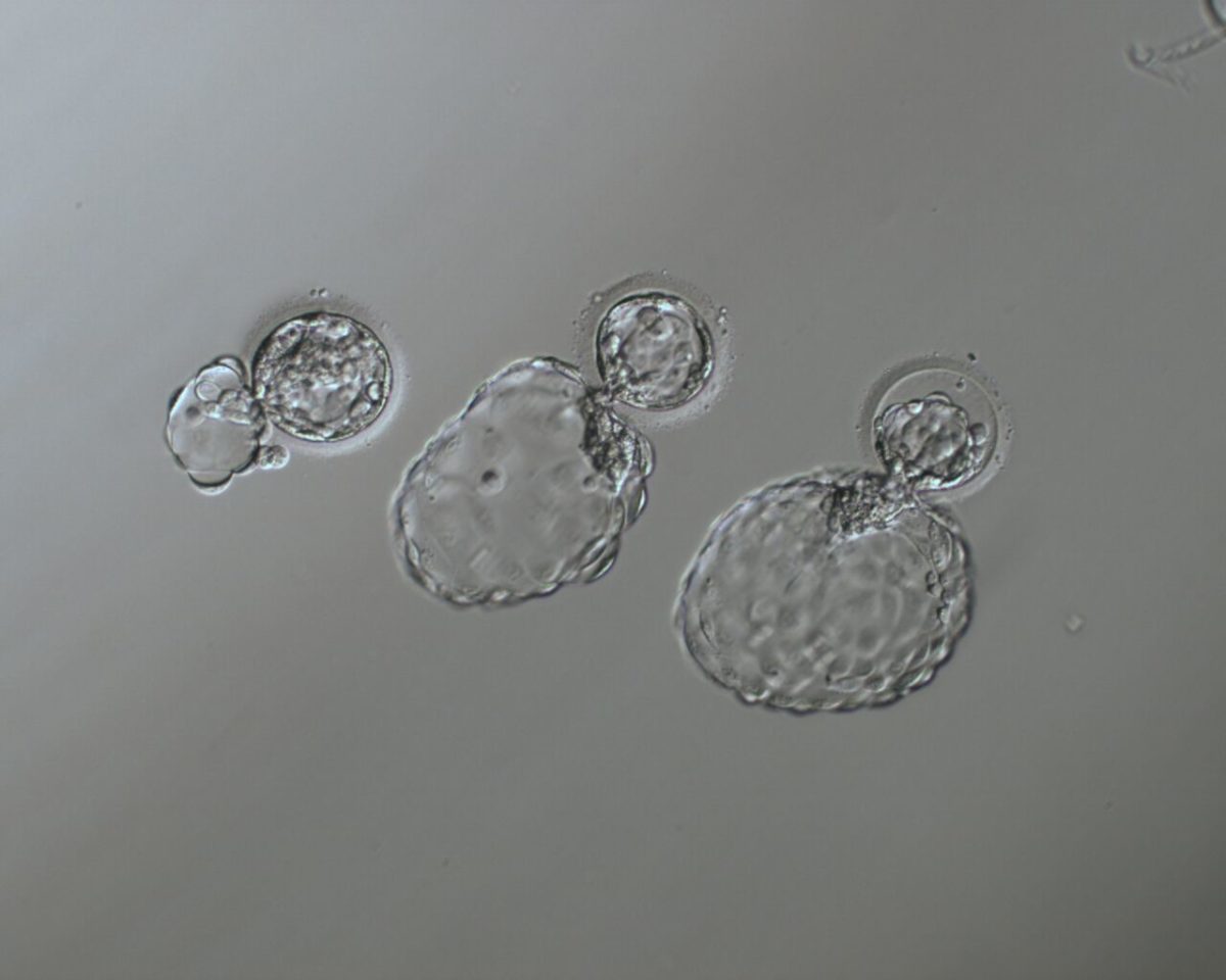 Post image - Embryo Expansion
