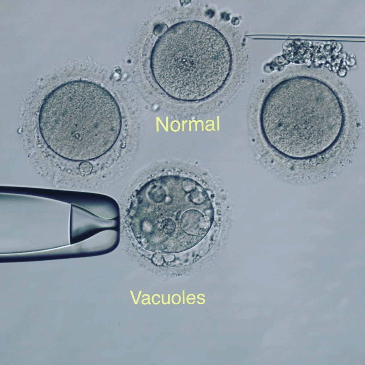 Post image - What's Going on with Vacuoles?