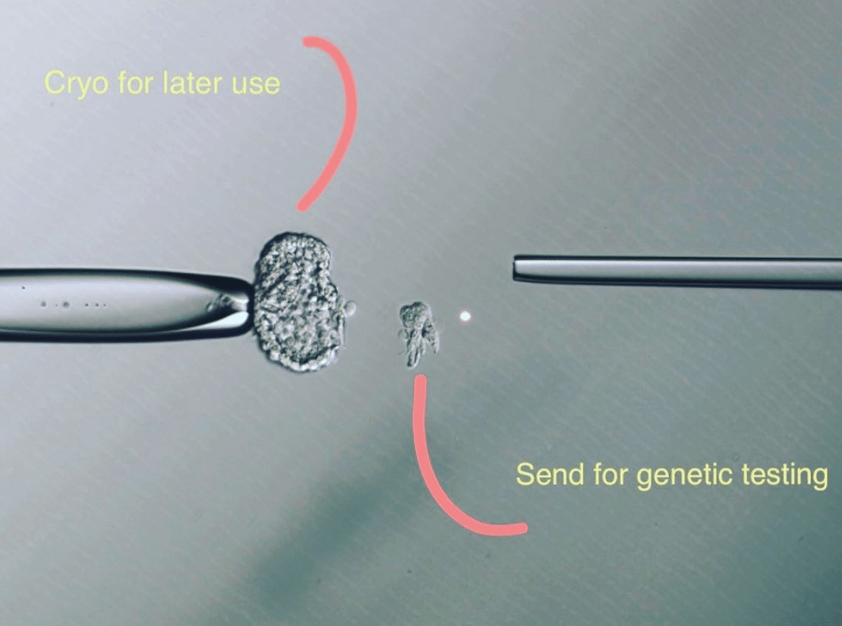 Post image - The Embryo Biopsy
